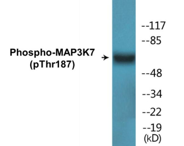 MAP3K7 (Phospho-Thr187)Colorimetric Cell-Based ELISA Kit (CBCAB00494)