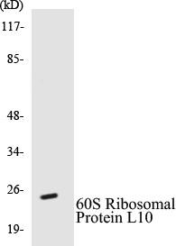 60S Ribosomal Protein L10 Colorimetric Cell-Based ELISA Kit (CBCAB00508)