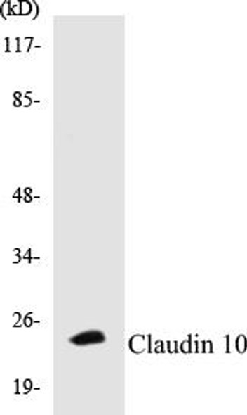 Claudin 10 Colorimetric Cell-Based ELISA Kit (CBCAB00583)