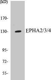 EPHA2/3/4 Colorimetric Cell-Based ELISA Kit (CBCAB00638)