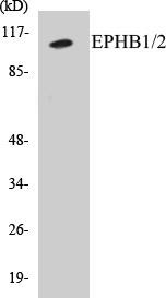 EPHB1/2 Colorimetric Cell-Based ELISA Kit (CBCAB00641)