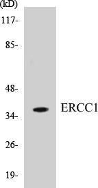 ERCC1 Colorimetric Cell-Based ELISA Kit (CBCAB00647)