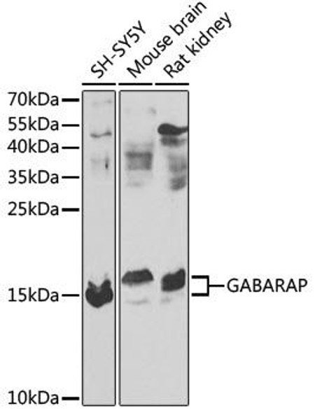 Anti-GABARAP Antibody (CAB13855)