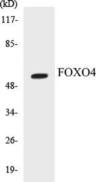 FOXO4 Colorimetric Cell-Based ELISA Kit (CBCAB00662)