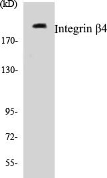 Integrin beta4 Colorimetric Cell-Based ELISA Kit (CBCAB00716)