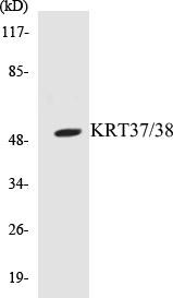KRT37/38 Colorimetric Cell-Based ELISA Kit (CBCAB00733)