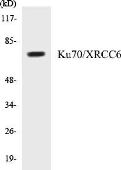 Ku70/XRCC6 Colorimetric Cell-Based ELISA Kit (CBCAB00735)