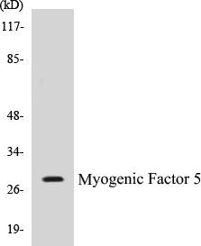 Myogenic Factor 5 Colorimetric Cell-Based ELISA Kit (CBCAB00774)