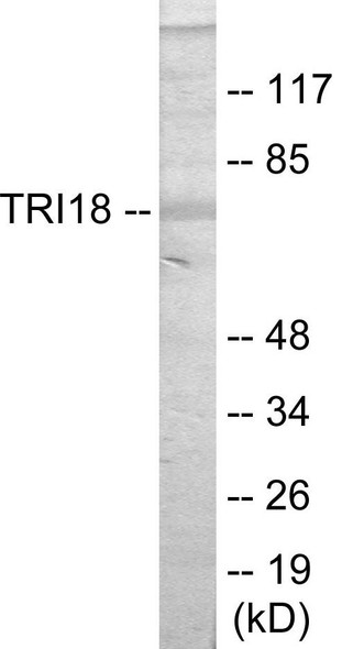 TRI18 Colorimetric Cell-Based ELISA (CBCAB00929)