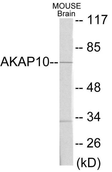 AKAP10 Colorimetric Cell-Based ELISA (CBCAB00935)