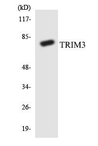 TRIM3 Colorimetric Cell-Based ELISA (CBCAB00948)