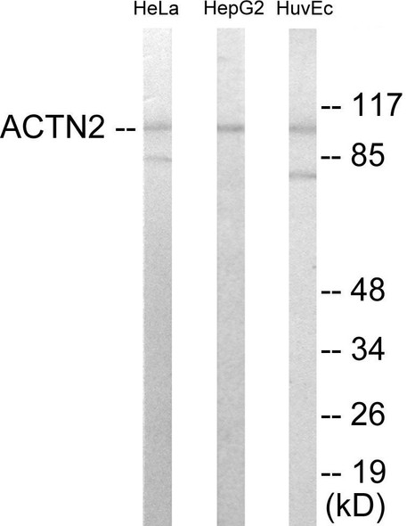 Actinin alpha-2/3 Colorimetric Cell-Based ELISA (CBCAB01005)