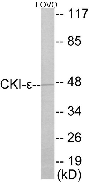 CKI-epsilon Colorimetric Cell-Based ELISA (CBCAB01019)