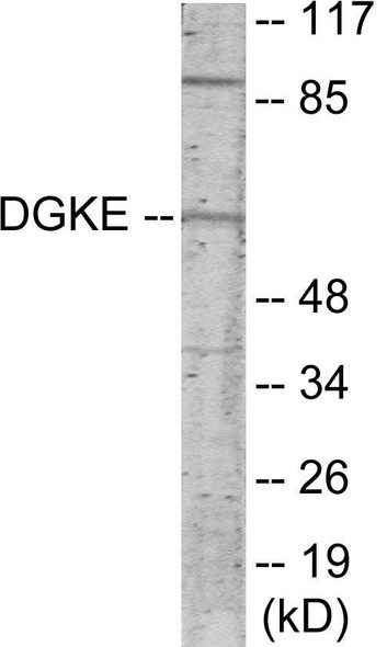 DGKE Colorimetric Cell-Based ELISA (CBCAB01031)