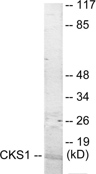 CKS1 Colorimetric Cell-Based ELISA (CBCAB01047)