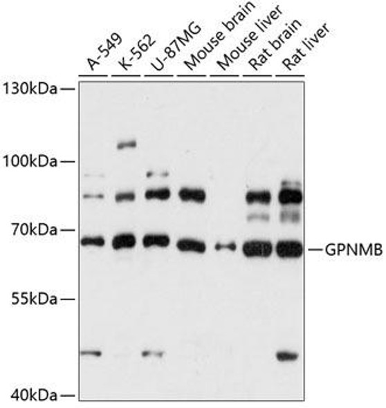 Anti-GPNMB Antibody (CAB14270)