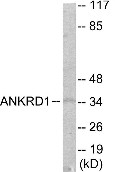 ANKRD1 Colorimetric Cell-Based ELISA (CBCAB01106)
