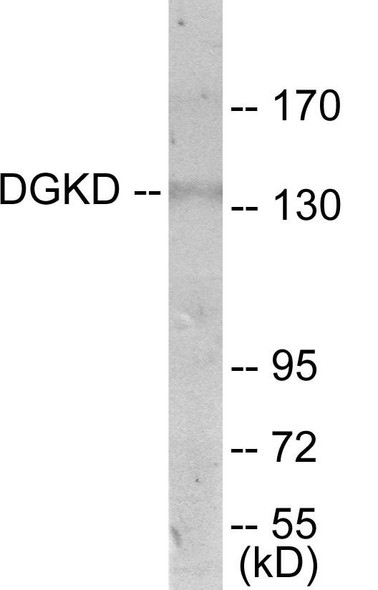 DGKD Colorimetric Cell-Based ELISA (CBCAB01123)