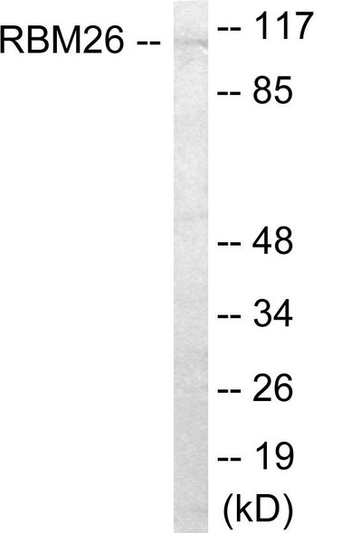 RBM26 Colorimetric Cell-Based ELISA (CBCAB01133)