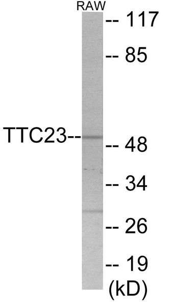 TTC23 Colorimetric Cell-Based ELISA (CBCAB01135)