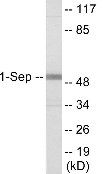 SEPT1 Colorimetric Cell-Based ELISA (CBCAB01167)