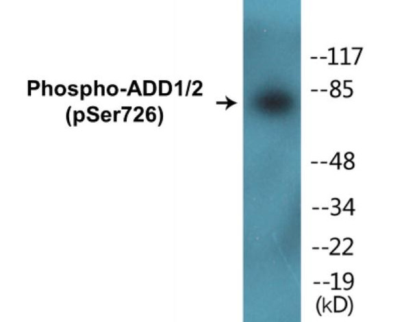 ADD1/2 (Phospho-Ser726)Colorimetric Cell-Based ELISA Kit (CBCAB01209)