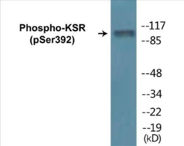 KSR (Phospho-Ser392)Colorimetric Cell-Based ELISA Kit (CBCAB01244)