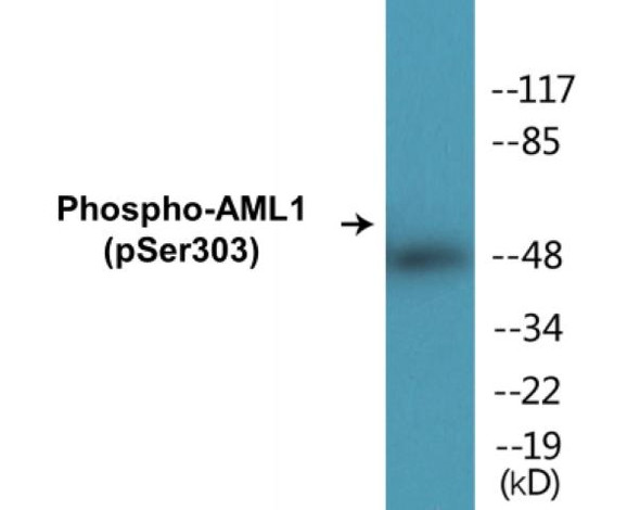 AML1 (Phospho-Ser303)Colorimetric Cell-Based ELISA Kit (CBCAB01262)