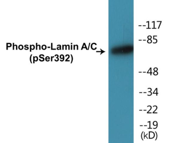 Lamin A/C (Phospho-Ser392)Colorimetric Cell-Based ELISA Kit (CBCAB01298)