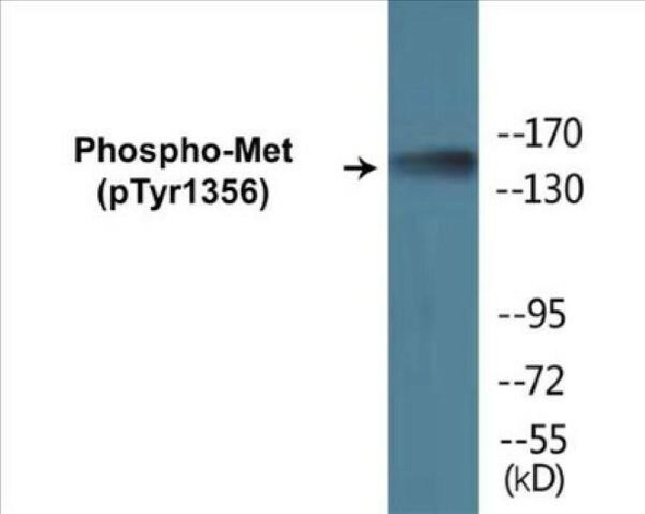 Met (Phospho-Tyr1356)Colorimetric Cell-Based ELISA Kit (CBCAB01301)