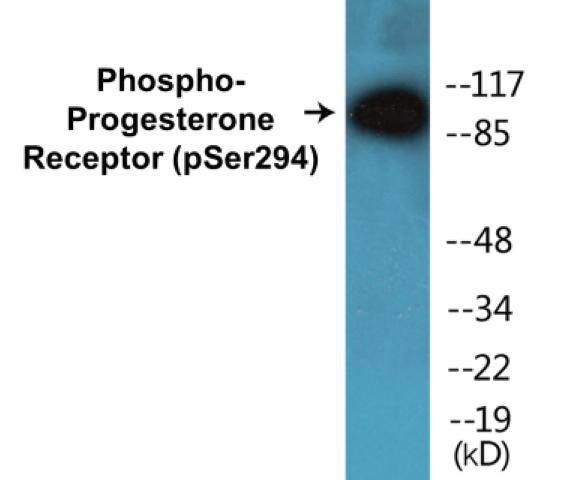 Progesterone Receptor (Phospho-Ser294)Colorimetric Cell-Based ELISA Kit (CBCAB01312)