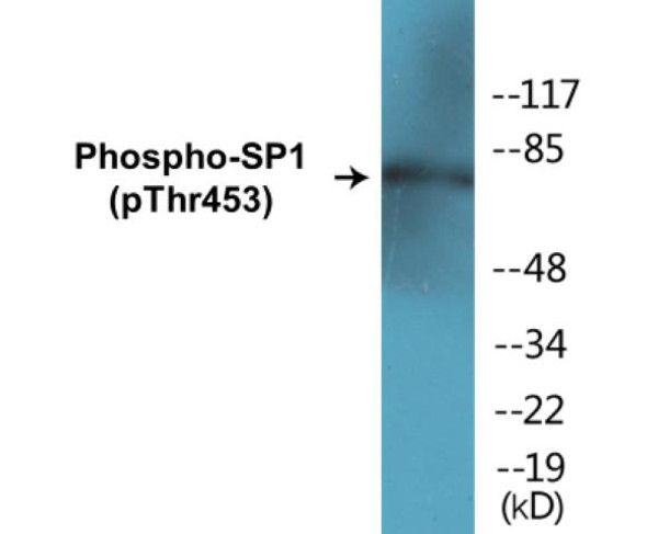 SP1 (Phospho-Thr453)Colorimetric Cell-Based ELISA Kit (CBCAB01320)