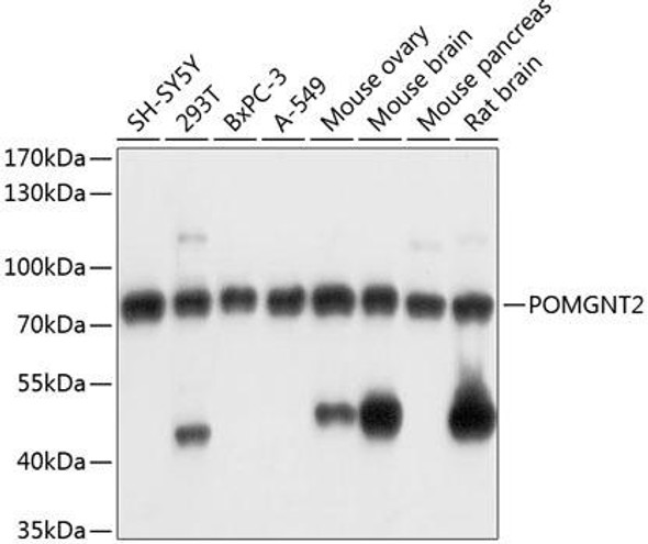 Anti-POMGNT2 Antibody (CAB14518)