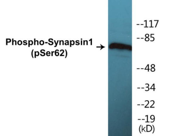 Synapsin1 (Phospho-Ser62)Colorimetric Cell-Based ELISA Kit (CBCAB01323)
