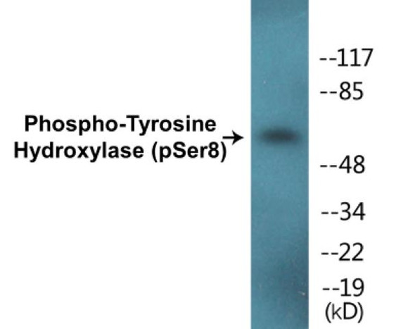 Tyrosine Hydroxylase (Phospho-Ser8)Colorimetric Cell-Based ELISA Kit (CBCAB01328)