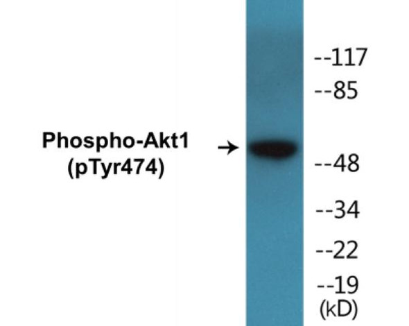 Akt1 (Phospho-Tyr474)Colorimetric Cell-Based ELISA Kit (CBCAB01333)