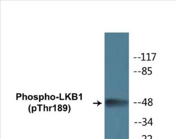 LKB1 (Phospho-Thr189)Colorimetric Cell-Based ELISA Kit (CBCAB01343)