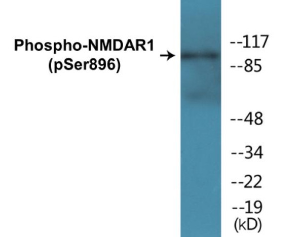 NMDAR1 (Phospho-Ser896)Colorimetric Cell-Based ELISA Kit (CBCAB01348)