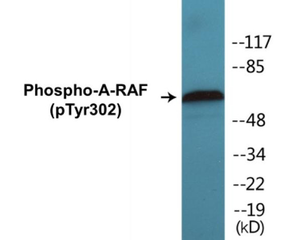 A-RAF (Phospho-Tyr302)Colorimetric Cell-Based ELISA Kit (CBCAB01365)