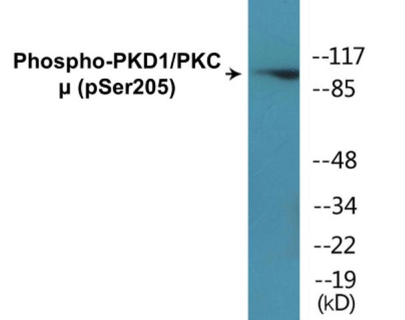 PKD1/PKC mu (Phospho-Ser205)Colorimetric Cell-Based ELISA Kit (CBCAB01379)