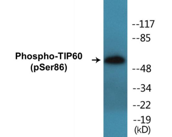 TIP60 (Phospho-Ser86)Colorimetric Cell-Based ELISA Kit (CBCAB01382)