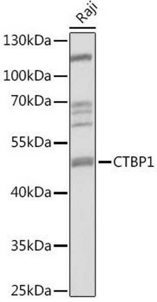 Anti-CTBP1 Antibody (CAB14616)