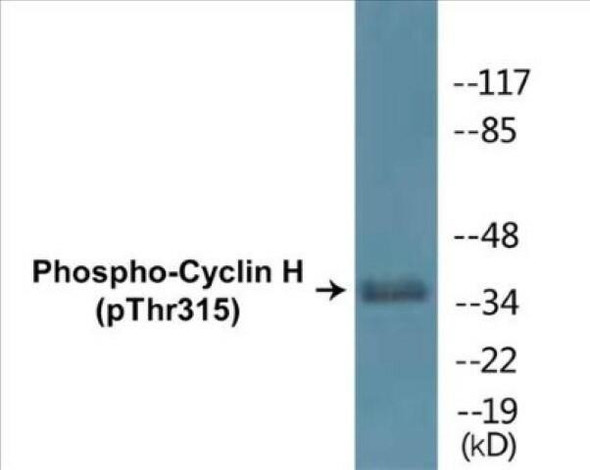 Cyclin H (Phospho-Thr315)Colorimetric Cell-Based ELISA Kit (CBCAB01407)