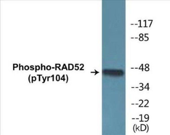 RAD52 (Phospho-Tyr104)Colorimetric Cell-Based ELISA Kit (CBCAB01464)