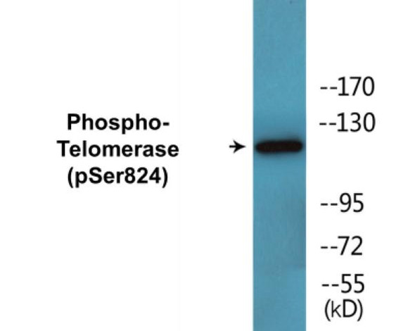 Telomerase (Phospho-Ser824)Colorimetric Cell-Based ELISA Kit (CBCAB01477)