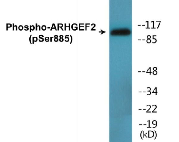 ARHGEF2 (Phospho-Ser885)Colorimetric Cell-Based ELISA Kit (CBCAB01485)