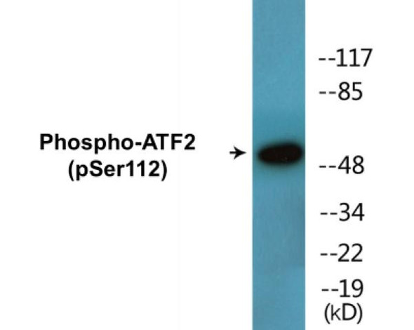 ATF2 (Phospho-Ser112)Colorimetric Cell-Based ELISA Kit (CBCAB01492)