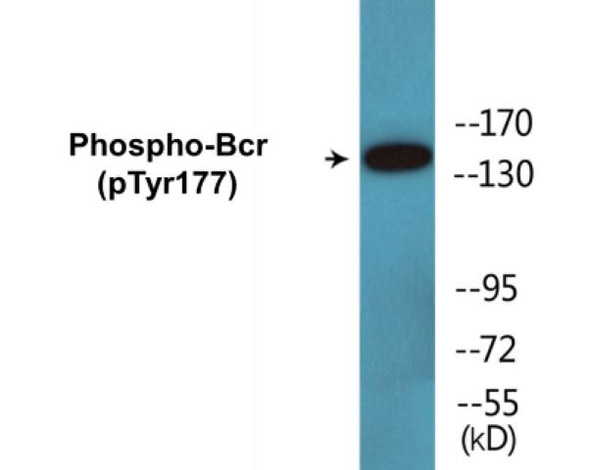 Bcr (Phospho-Tyr177)Colorimetric Cell-Based ELISA Kit (CBCAB01503)