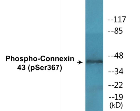 Connexin 43 (Phospho-Ser367)Colorimetric Cell-Based ELISA Kit (CBCAB01511)
