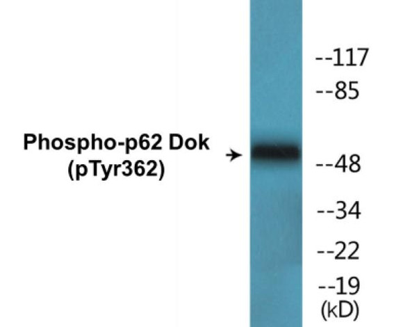 p62 Dok (Phospho-Tyr362)Colorimetric Cell-Based ELISA Kit (CBCAB01514)